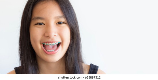 the face of asian girl that has braces and smile happily with the space on the right 
