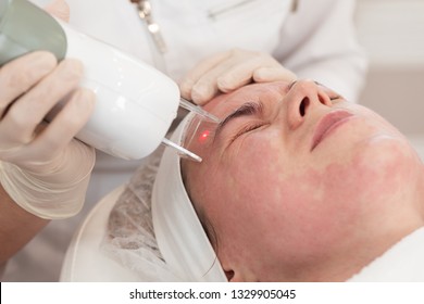 Face Beauty Treatment Close-up. Close-up Of Woman Getting Facial Laser Polishing And Rejuvenation Face Procedure, Experiences Pain And Discomfort. Cosmetologist Using Hardware Apparatus.