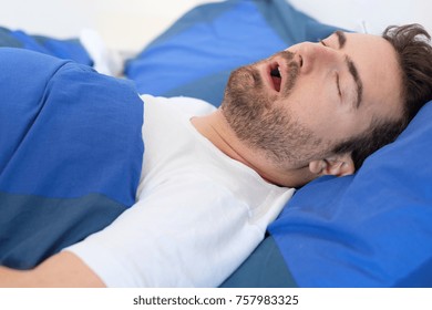 Face Close Up Of Snoring Man Because Of Hypopnea Disorder