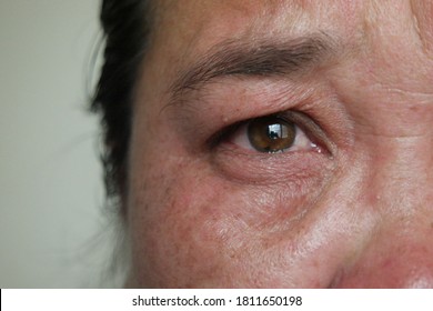 Face and eyes,45s Asian woman.Her brown eyes filled up with tears.Depression,stress in postmenopausal women or menopause or Middle-aged.Hormonal changes cause her to regret or cry.Selective focus.