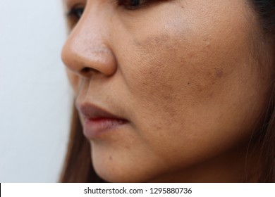 The face of the girl has freckles and large pores - Shutterstock ID 1295880736