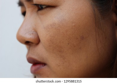 The face of the girl has freckles and large pores - Shutterstock ID 1295881315