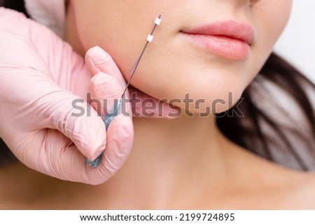Face lifting PDO Suture operation. innovative technique of New thread lift, cosmetologist preparing to do procedure to female client, select the appropriate thread option