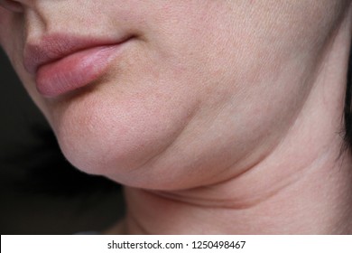 569 Mouth to chin lines Images, Stock Photos & Vectors | Shutterstock