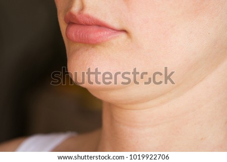face line correction. a woman with a second chin

