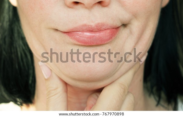 face line\
correction. a woman with a second\
chin