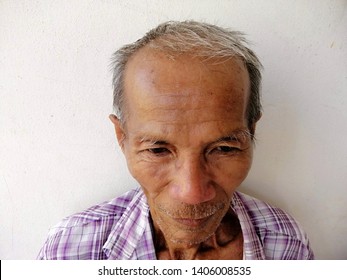 The Face Of An Old Man With Glabrous, Thin White Hair, White Beard, Wrinkled Skin,slim Shape,gaunt  .. Everything Is Caused By Aging.