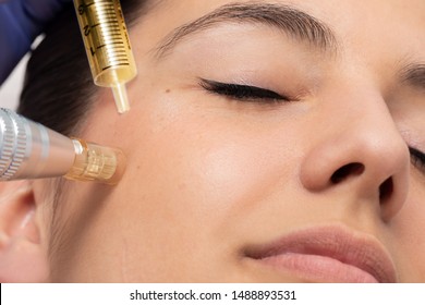 Face Shot Of Woman Having Micro Needle Cosmetic Treatment On Face.Therapist Reducing Crow's Feet Around Eyes Injecting Hormones And Proteins.