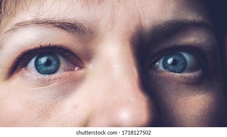 chimera human eyes