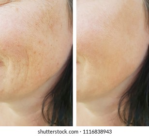 face woman wrinkles - Shutterstock ID 1116838943