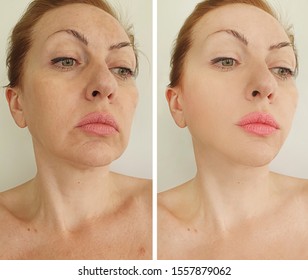 942 Woman fat face before after Images, Stock Photos & Vectors ...