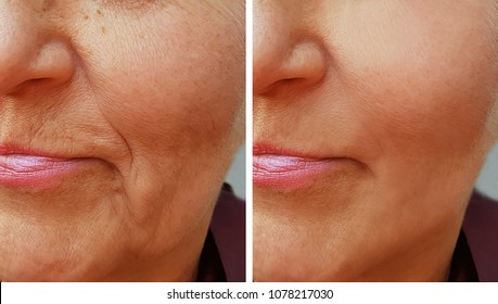 face wrinkle on old woman 