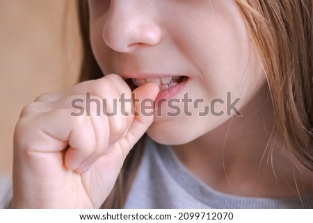 face young girl bites her fingernails. bad habit