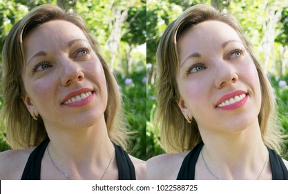 Face Of A Young Woman Before And After The Photoshop Retouch  Or Treatment.