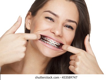 Face of a young woman with braces on her teeth - Shutterstock ID 453589747