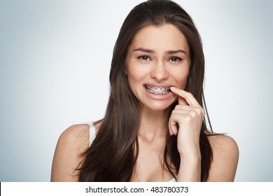 Face Of A Young Woman With Braces On Her Teeth