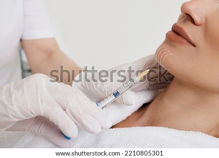 Facelift woman chin and lower face using beauty injection, non surgery. Process lifting face contour at cosmetology, close-up