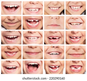 Faces Of Smiling Children. Set Of Kids Smiles. Healthy Teeth. Smile.