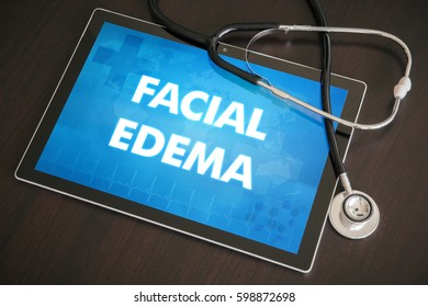 Facial Edema (cutaneous Disease) Diagnosis Medical Concept On Tablet Screen With Stethoscope.