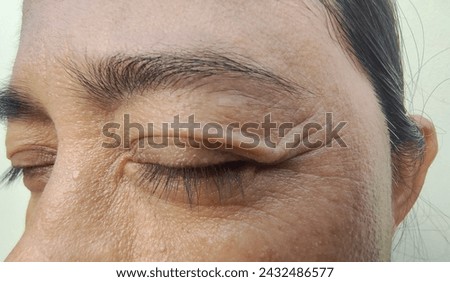 Facial skin problems of crow's feets with freckles, dark spots and wrinkles on the faces of middle-aged Asain women, frowning, Dull and rough skin, Isolated on white background and beauty concept