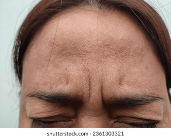 Facial skin problems of freckles, dark spots and wrinkles on the faces of middle-aged women stressed expression, frowning, frown, Dry and rough skin, isolated on white background and healthy concept - Shutterstock ID 2361303321