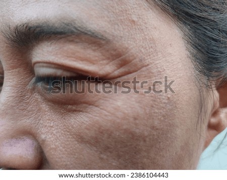 Facial skin problems of freckles, dark spots and wrinkles on the faces of Asain women stressed expression, crow feets, frowning, Dry and rough skin, Isolated on white background and concept of healthy