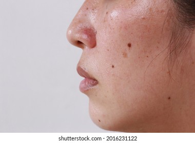 Facial skin problems for women and health problems Dark spots with freckles and blemishes with copy space - Shutterstock ID 2016231122