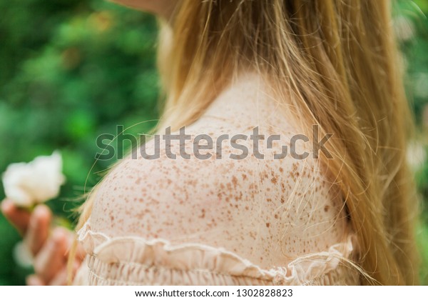 fair-skin-freckled-ginger-girl-600w-1302