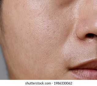 Fair Skin With Wide Pores In Face Of Southeast Asian, Myanmar Or Korean Adult Young Man. Closeup View.