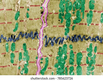 False Colour Electron Microscope Micrograph Showing An Intercalated Disc (blue) Between Heart Muscle Cells. The Z Lines (red), Mitochondria (green) And Basement Membranes (pink) Are Also Labelled.