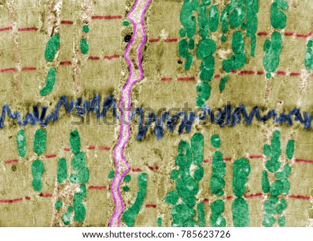 False colour electron microscope micrograph showing an intercalated disc (blue) between heart muscle cells. The Z lines (red), mitochondria (green) and basement membranes (pink) are also labelled.