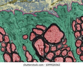 False colour TEM micrograph showing the surface of CNS white matter. Processes of fibrous astrocytes (yellow). Myelinated fibers (red). Meninges (yellow). Basal lamina (pink)