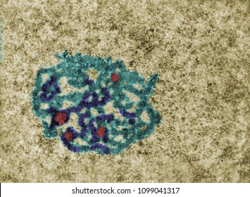 False colour TEM micrograph showing a nucleolus with the fibrogranular (light blue) and fibrillar components (dark blue). Fibrillar centers (the nucleolus organizer regions-NORs) (red).