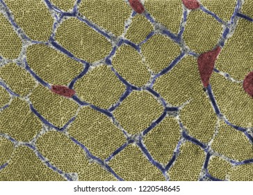 False Colour Transmission Electron Micrograph (TEM) Showing Cross-sectioned Muscle Myofibrils At The A-band Level (yellow), Mitochondria (red) And Terminal Cisternae Of Sarcoplasmic Reticulum (blue)