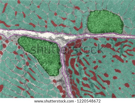 False colour transmission electron micrograph (TEM) showing three cross-sectioned muscle cells. Myofibrils (blue), nuclei (green), mitochondria (red) and basal lamina (pink).