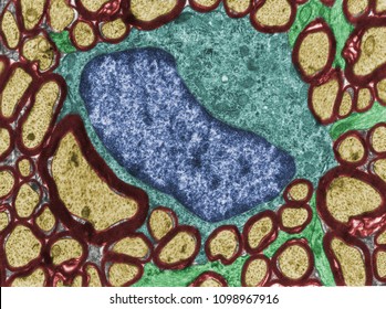 False colour transmission electron microscope (TEM) micrograph showing an oligodendrocyte (blue) among myelinated fibers (dark red) and some astrocyte processes (green).