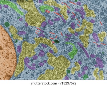 False Colour Transmission Electron Microscope (TEM) Micrograph Of A Neuron Cell Body Showing Mitochondria (pink), Lysosomes (green), Microtubules (red), RER (yellow) And Golgi (light Green).