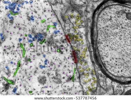 False colour transmission electron microscope (TEM) micrograph showing two synapses. Synaptic densities=red. Synaptic vesicles=yellow. Ribosomes=blue. RER=green. Microtubules=pink 