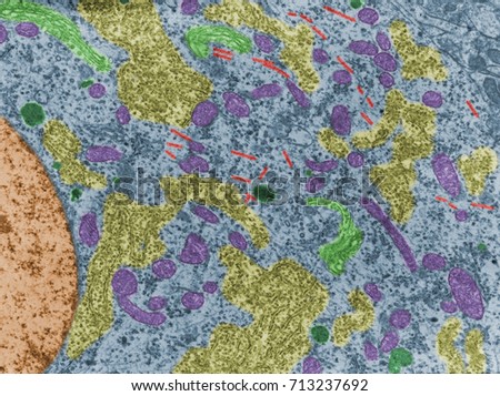 False colour transmission electron microscope (TEM) micrograph of a neuron cell body showing mitochondria (pink), lysosomes (green), microtubules (red), RER (yellow) and Golgi (light green).