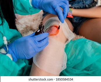 Family Doctor Treats A Wound With An Antiseptic On The Knee Of A Teenager Child