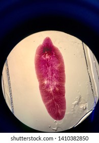 fasciola hepatica slide