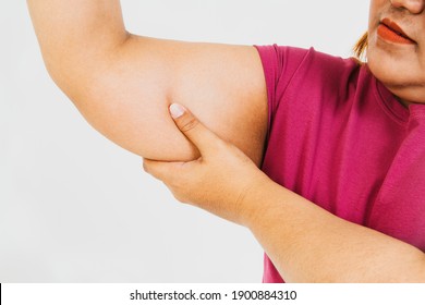 Fat Asian woman touches her right arm, pulling unwanted fat cellulite under her arm with anxiety and shedding her unattractive figure : Concept Health care of obese women
