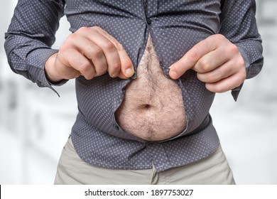 Fat Belly Of Man Which Does Not Fit Under The Shirt - Obesity Concept