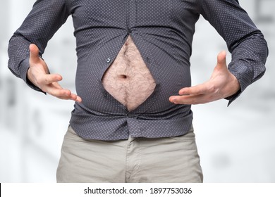 Fat Belly Of Man Which Does Not Fit Under The Shirt - Obesity Concept