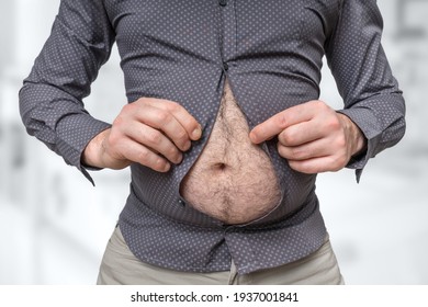 Fat Belly Of Man Which Does Not Fit Under The Shirt - Obesity Concept