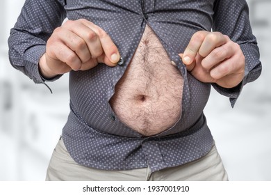 Fat Belly Of Man Which Does Not Fit Under The Shirt - Obesity Concept