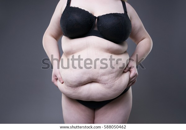 fat-female-belly-overweight-body-600w-588050462.jpg