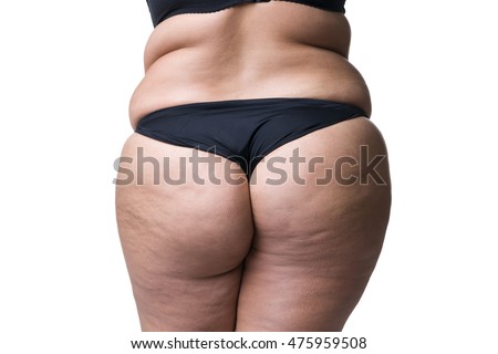 Fat female body with cellulite, fatty hips and buttocks, isolated on white background