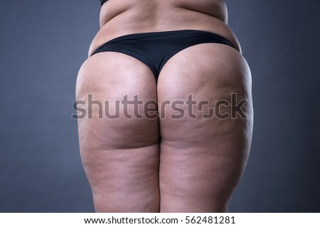 Fat female body with cellulite, fatty hips and buttocks on gray background