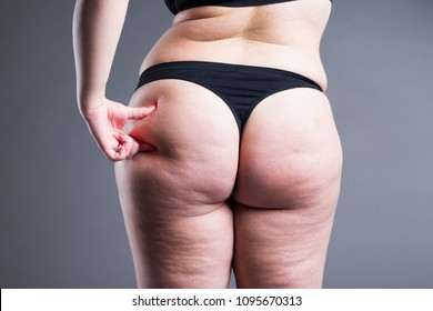 Bbw Cellulite Thighs And Ass